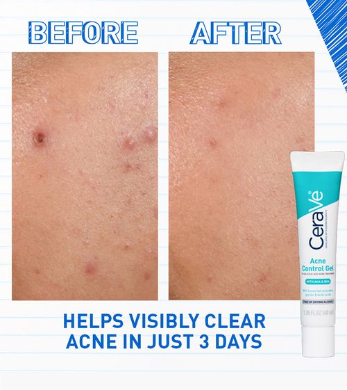 CeraVe-Acne Control Gel 40ml