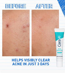 CeraVe-Acne Control Gel 40ml